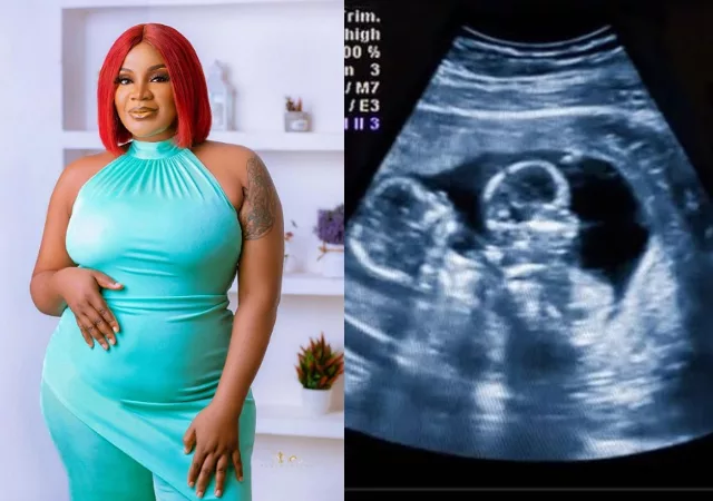 “Mama Ejima” Prayers pour in for Uche Ogbodo as she shares her ultrasound result